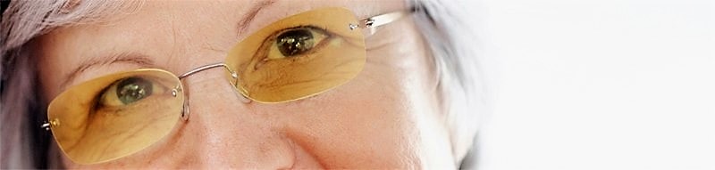 Gafa para DMAE Optica Alba Murcia